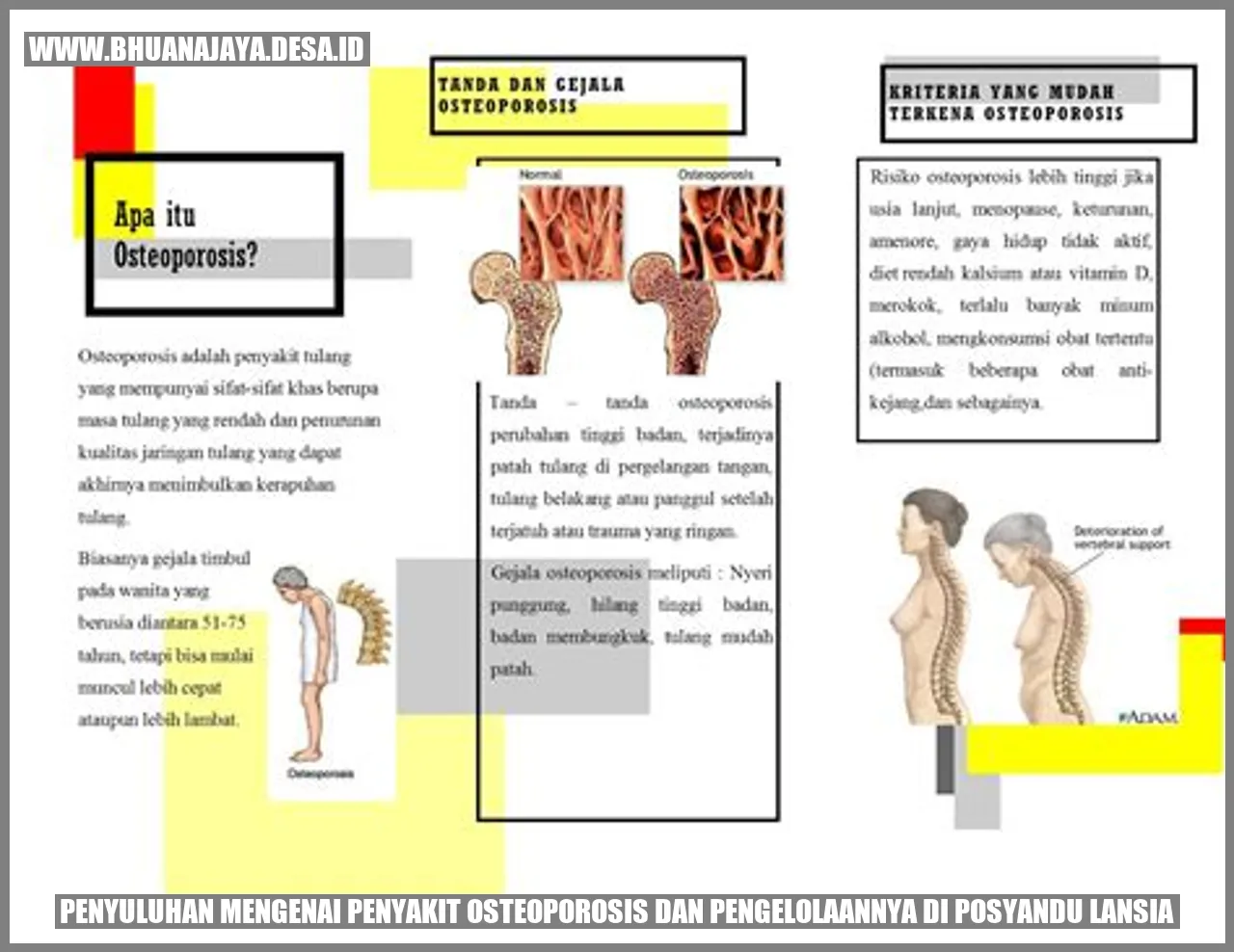 Penyuluhan Mengenai Penyakit Osteoporosis dan Pengelolaannya di Posyandu Lansia